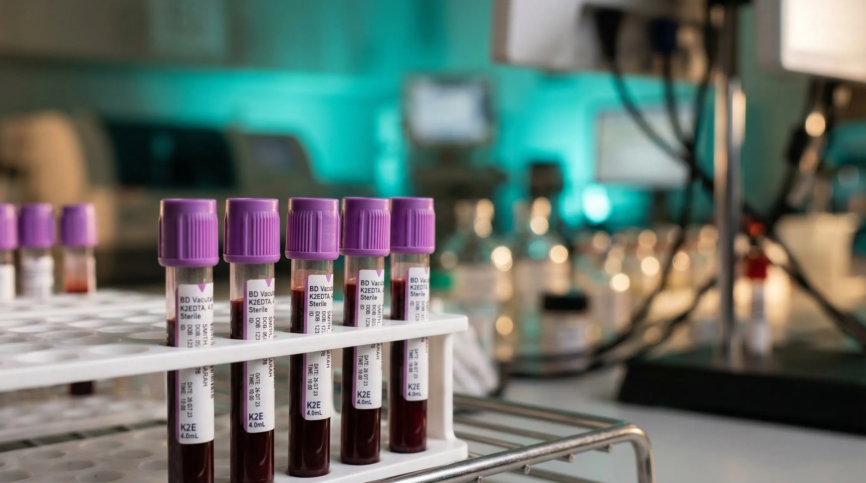 Hemograma completo: o que cada valor revela sobre sua saúde